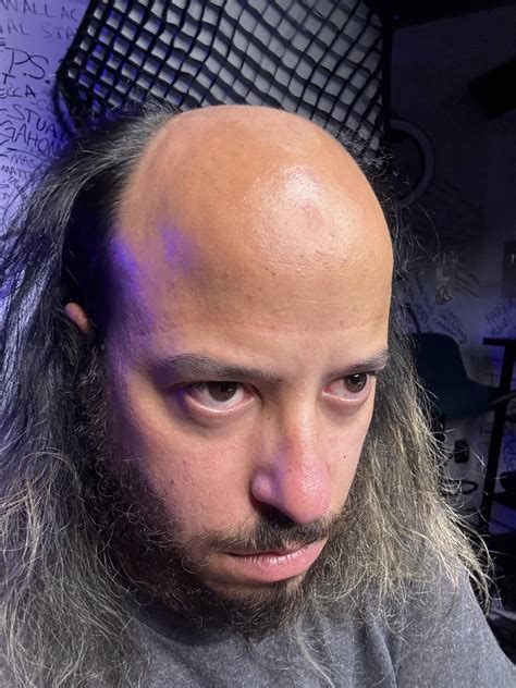 goose wayne hair|how i went bald .